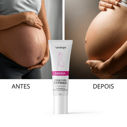 Creme Anti-estrias Natural: Previna e Reduza Marcas de Estrias
