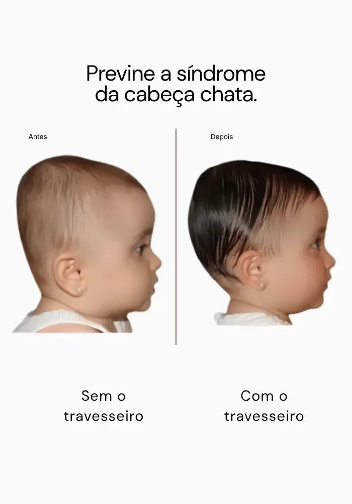 Travesseiro de Proteção Infantil Winshape